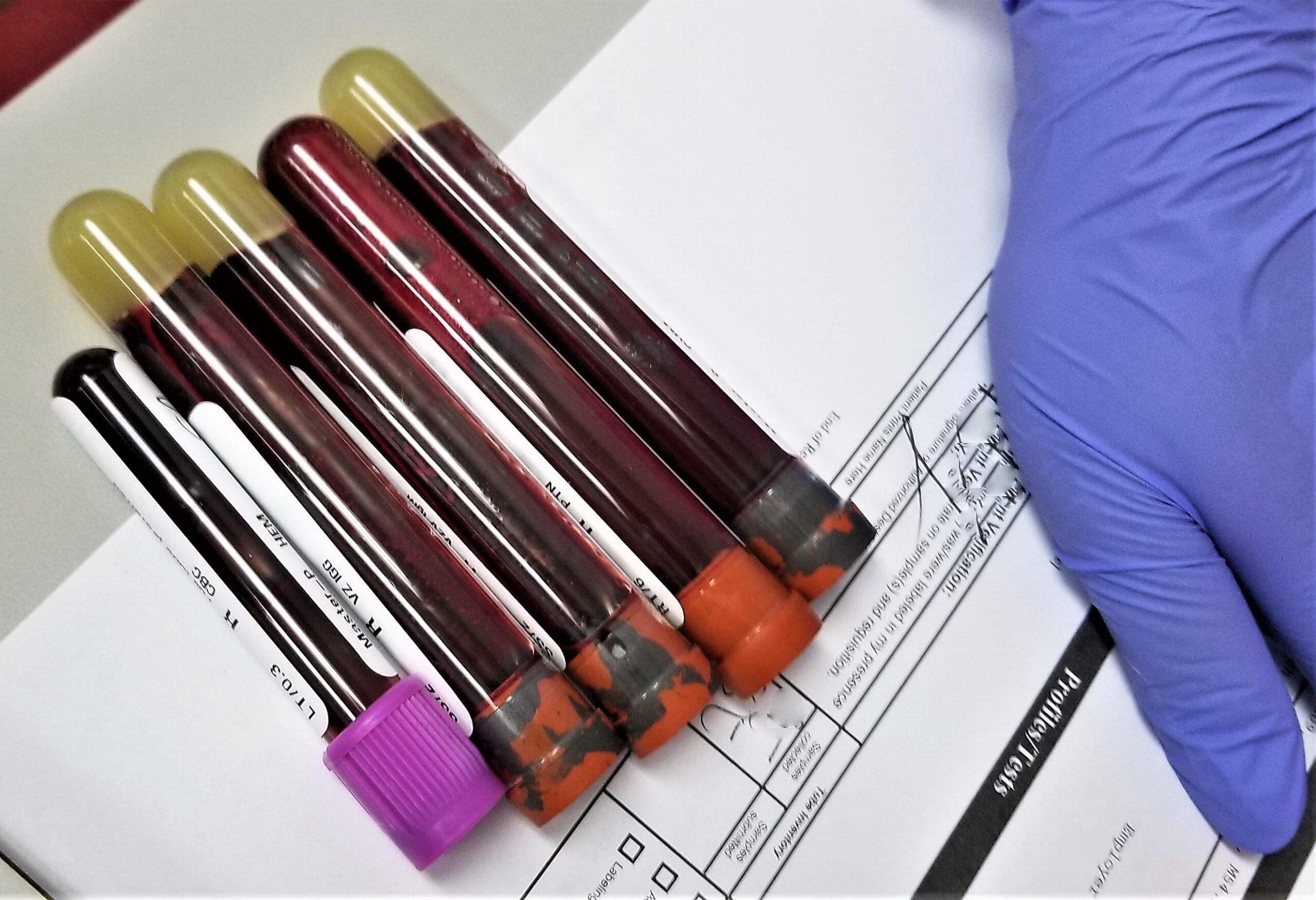 Travel Phlebotomist Salary: Complete Compensation Guide for Mobile Blood Draw Professionals